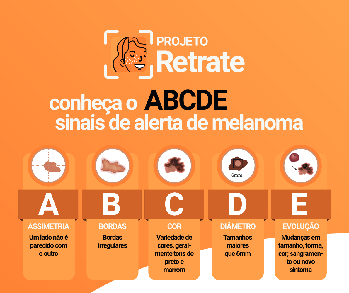 ABCDE